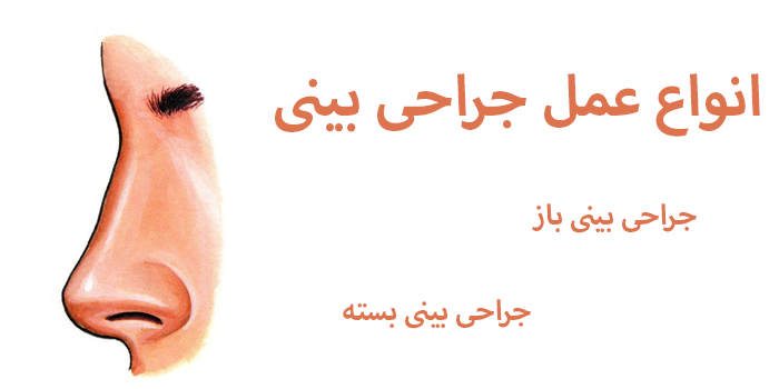 انواع جراحی بینی
