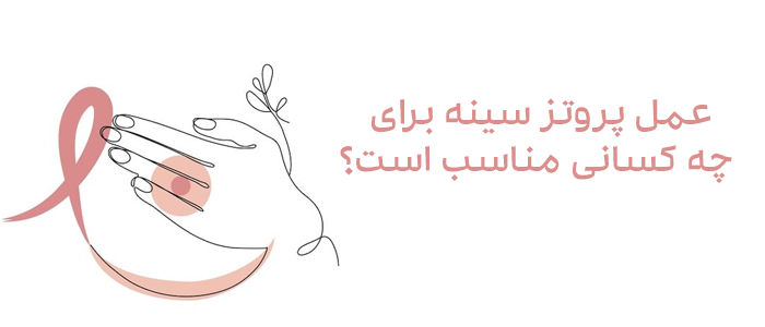 کاندید پروتز سینه