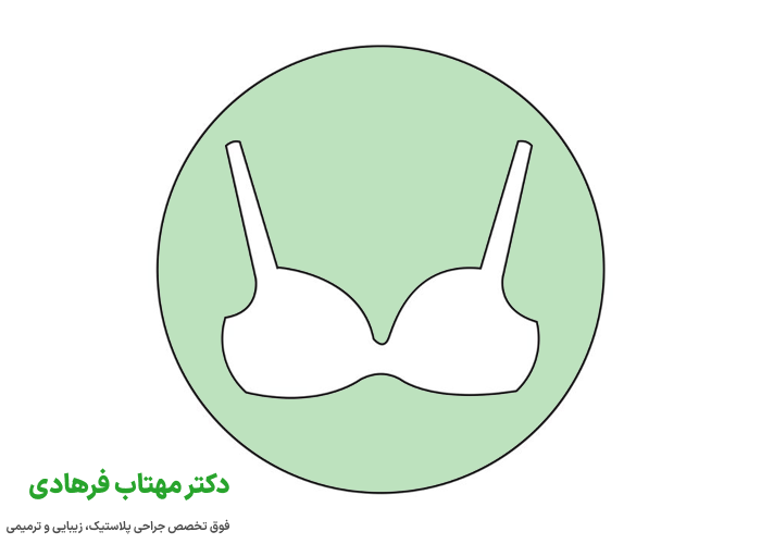 سوتین طبی پس از جراحی پروتز سینه