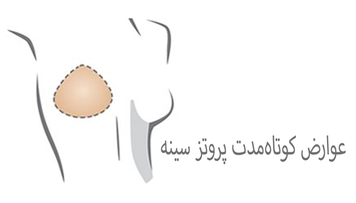 عوارض کوتاه‌مدت پروتز سینه