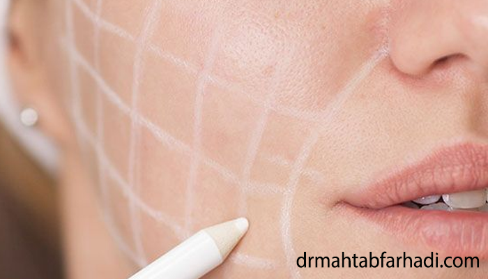 مزایای تزریق چربی به صورت