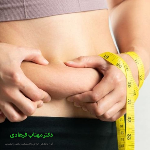 جراح لیپوساکشن