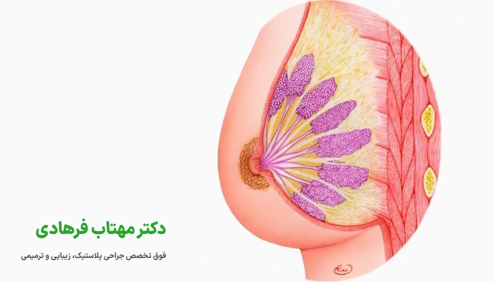 درد در روزهای اول پس از عمل پروتز سینه