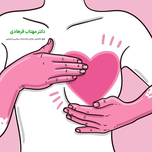 عمل زیبایی سینه زنان 