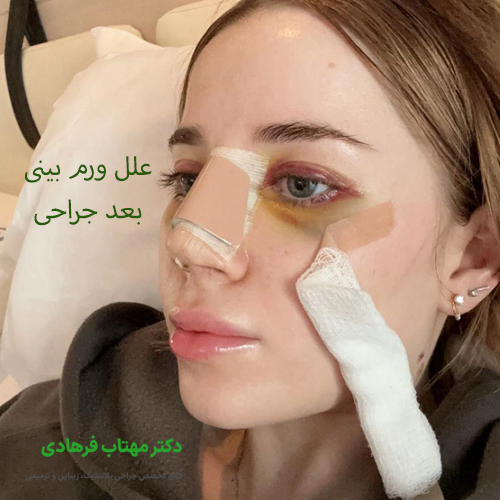 علل ورم بینی بعد جراحی