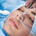 عمل بینی برای چه کسانی خطرناک است؟