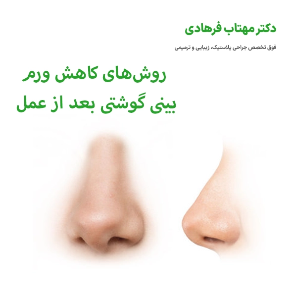 روش‌های کاهش ورم بینی گوشتی بعد از عمل