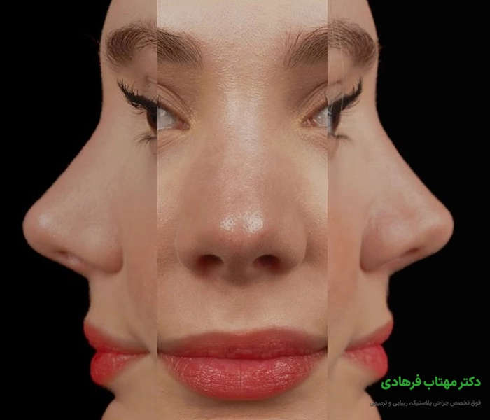  تفاوت بین ورم ناشی از جراحی، آلرژی و آسیب