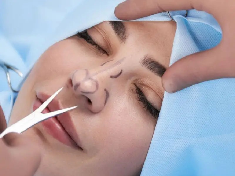 حداکثر سن عمل بینی